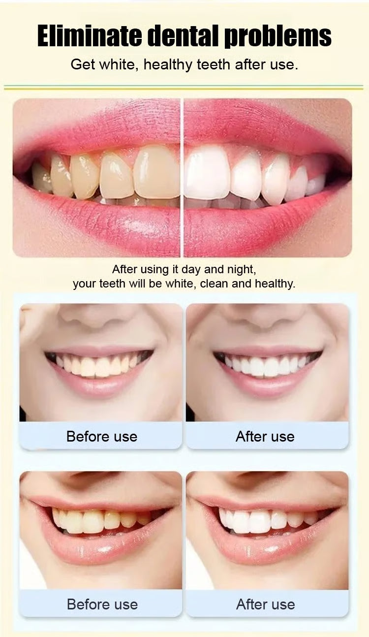 Super Probiotic-6 Toothpaste with 4 Probiotics Balance Oral microbiota strength