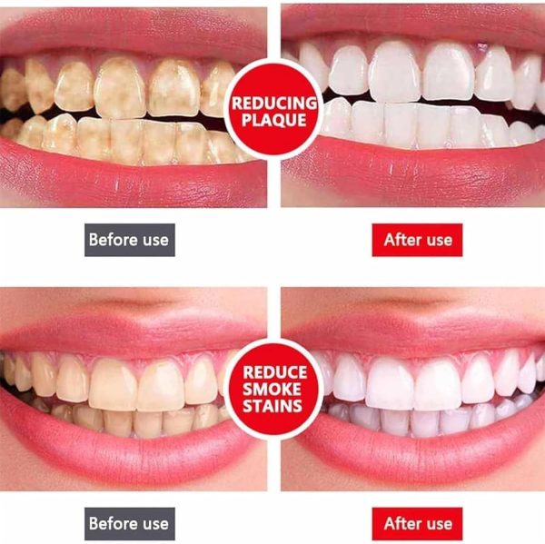 Super Probiotic-6 Toothpaste with 4 Probiotics Balance Oral microbiota strength