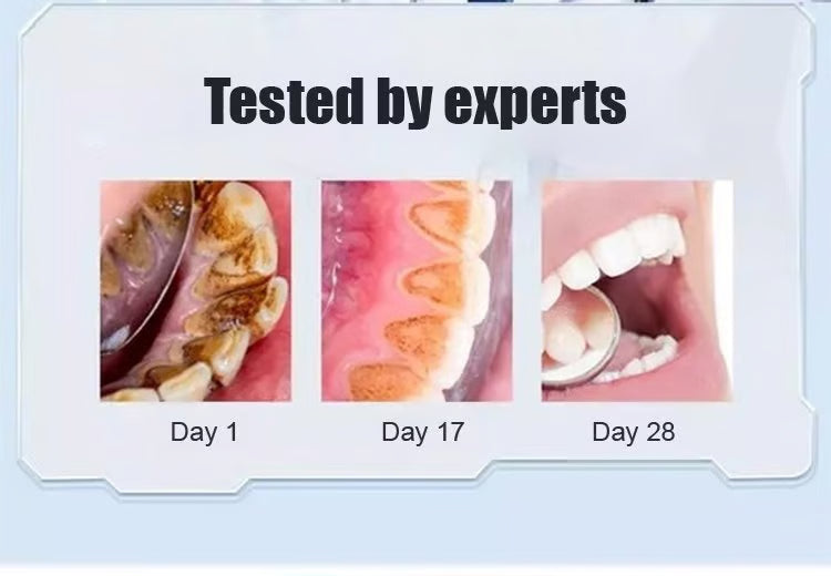 Super Probiotic-6 Toothpaste with 4 Probiotics Balance Oral microbiota strength