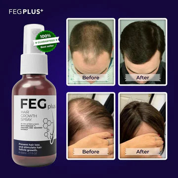 FEG PLUS Hair Growth Spray 50ml