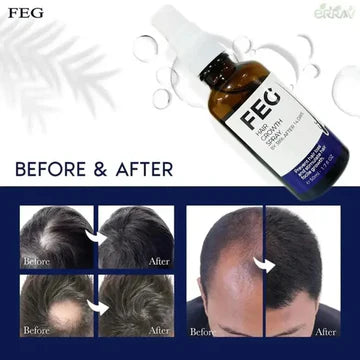 FEG PLUS Hair Growth Spray 50ml